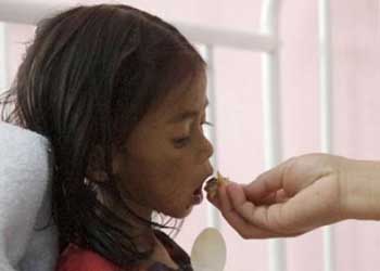 ويعاني 50% من الاطفال من سوء التغذية المزمن في غواتيمالا