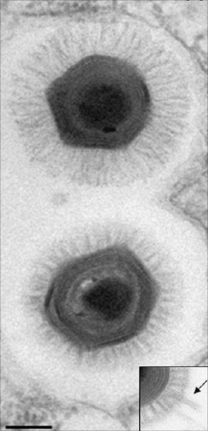 الفيروس العملاق مزود بشعيرات تخدع الأميبيات 