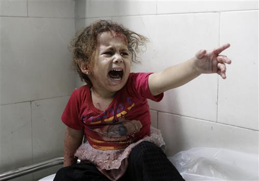 طفلة تبكي في مستشفى الشفاء في غزة جراء إصابتها في العدوان الإسرائيلي أمس (ا ف ب)