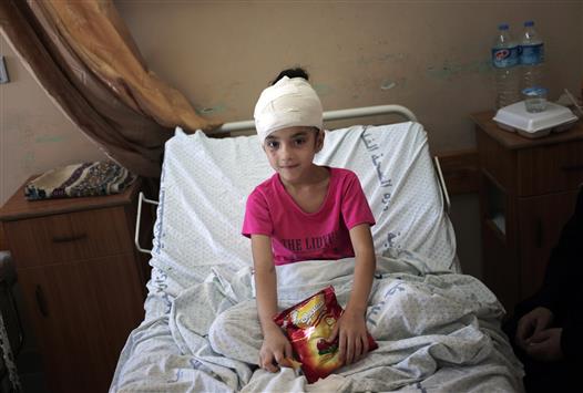طفلة في مستشفى الشفاء في غزة بعد اصابتها في العدوان الاسرائيلي (ا ب)