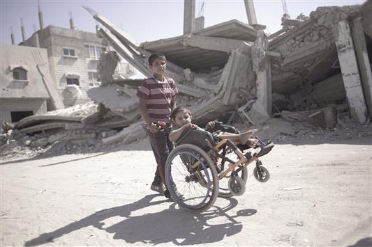 الطفل الفلسطيني ايمن مهموم الذي اصيب جراء القصف الاسرائيلي العشوائي على رفح، خلال العدوان على غزة، الصيف الماضي. (أ ف ب)