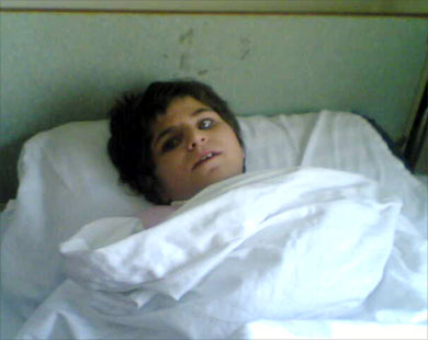 الطفلة منال مستلقية على سريرها في مركز الأسد الطبي حيث تتلقى العلاج