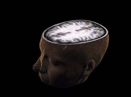 صورة غير مؤرخة لمخ الانسان التقطت بطريقة المسح التكنولوجي ويظهر خلالها استجابة المخ لمؤثر بصري