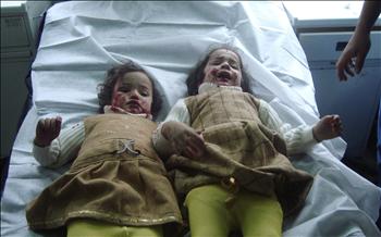 طفلتان أصيبتا في أحد التفجيرات تتلقيان العلاج في أحد مستشفيات بغداد أمس.