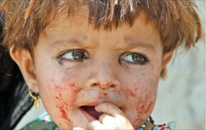 طفلة أفغانية في أحد مخيمات اللجوء داخل باكستان أمس 