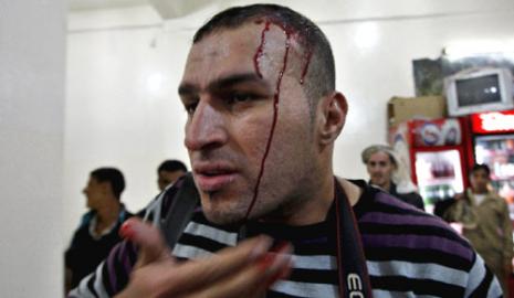 المصوّر أحمد غرابلي بعد الاعتداء عليه في صنعاء