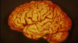 يضمر المخ البشري ويخف وزنه مع تقدم العمر