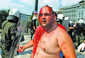 رجل أصيب في تظاهرات أثينا 
