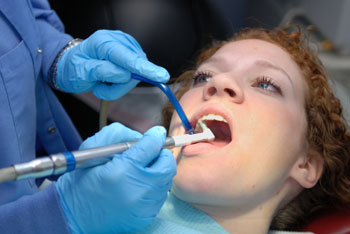 ابتكار تقنية جديدة لحفر الأسنان بعيداً عن الآلات المؤلمة