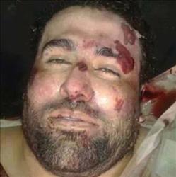 صورة نشرت على مواقع "جهادية" على الانترنت لجثة "عدنان خان" 