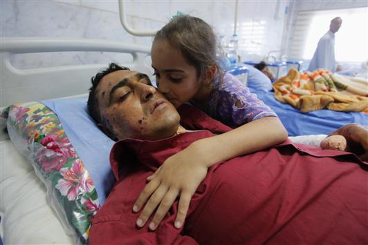 طفلة عراقية تقبل والدها الراقد في مستشفى في مدينة الحلة جراء إصابته في تفجير أمس (رويترز)