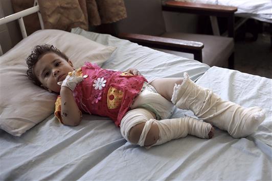 رضيعة فلسطينية تُعالج في مستشفى الشفاء في غزة امس (ا ب ا)